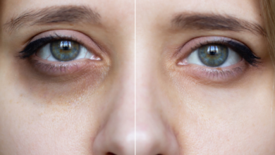 Do you know why you get dark circles under your eyes when you don’t get enough sleep?