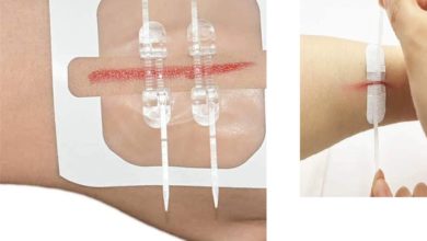 Seamless Healing: Color-Reveal Nano Wound Dressings- NO for Unwrapping!