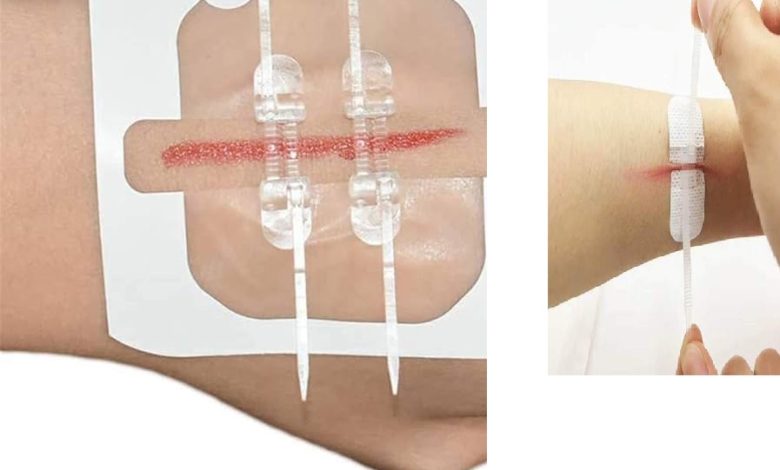 Seamless Healing: Color-Reveal Nano Wound Dressings- NO for Unwrapping! Seamless Healing: Color-Reveal Nano Wound Dressings- NO for Unwrapping!