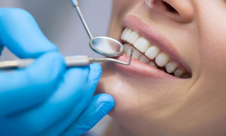 Nanoceria Nanoparticles as Synthetic Agglutinins for Dental Plaque Reduction